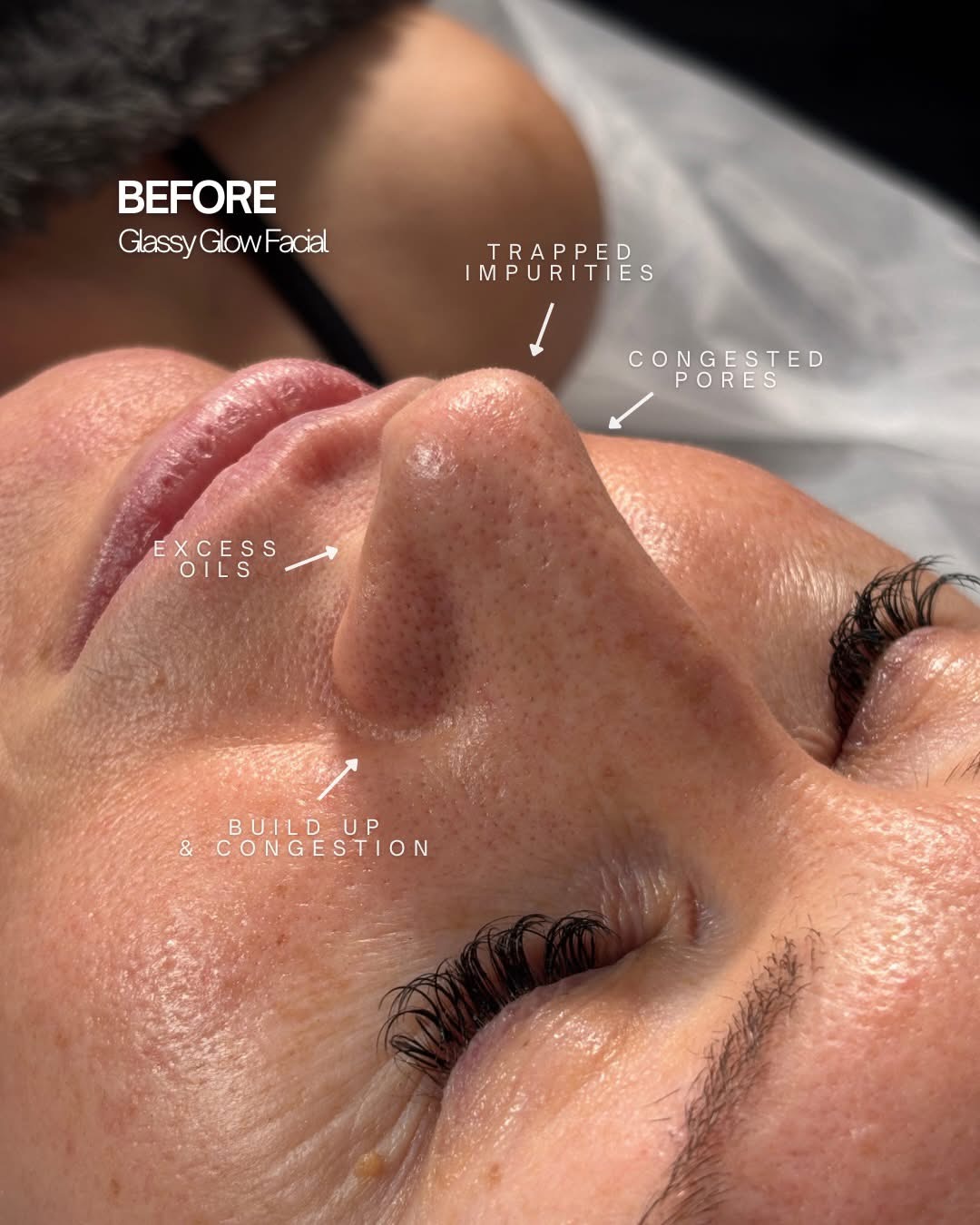 Skin concerns assessed before a Glassy Glow Facial