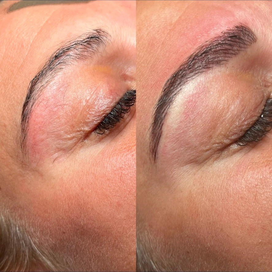 Before and after comparison of a semi-permanent brow treatment