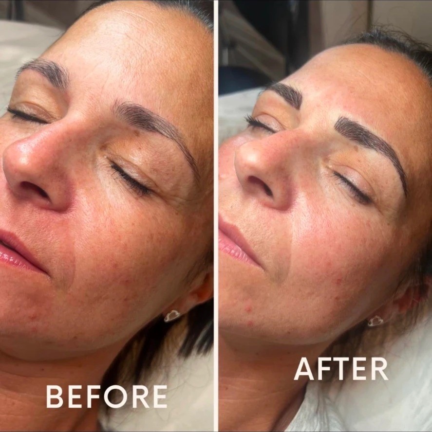 Before and after photos showing fuller, more defined semi-permanent eyebrows